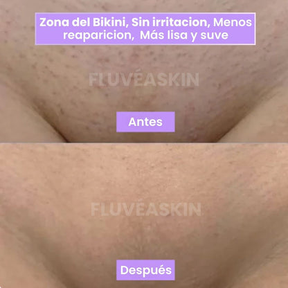 FluvéaSkin® - Vello más fino y menos visible con Raiz de Cyperus Rotundus